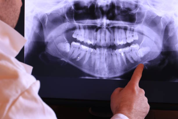Best Emergency Broken Tooth Repair in Prichard, AL
